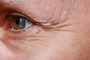 ANTI AGING